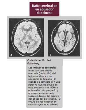 efectos de los inhalantes en las personas