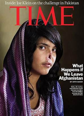 Cómo es la nueva vida de la joven afgana mutilada que conmocionó al mundo